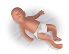 Images/Cerebral-Somatic_Baby_AbdominalB.jpg
